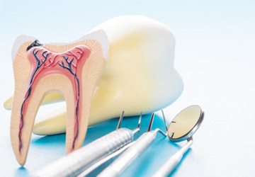 Model of tooth and inner nerves next to dental tools