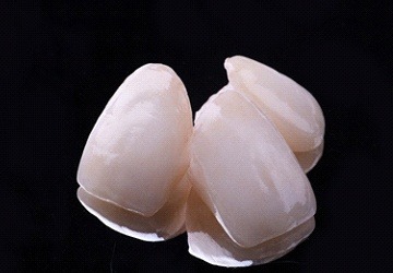 Three ceramic dental crowns against black background