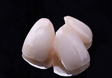 all-ceramic crowns