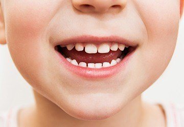 Closeup of child's healthy smile