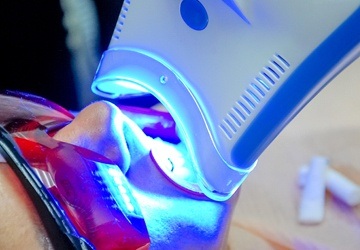 teeth whitening