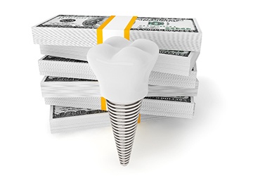 Implant and money stacks representing the cost of dental implants in Melbourne