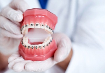 Dentist holding model of teeth with metal braces