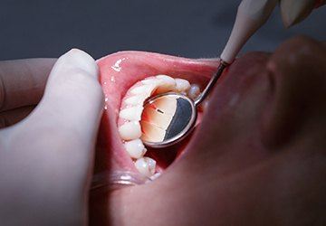 Closeup of patient receiving dental exam