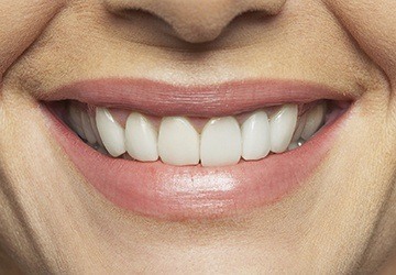 Closeup of healthy teeth and gums