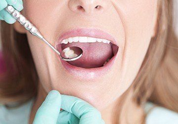 Closeup of patient receiving dental exam